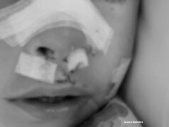 Jujuy: Niño de dos años sufre heridas en el rostro por mordedura de un perro