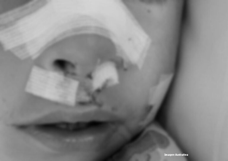 Jujuy: Niño de dos años sufre heridas en el rostro por mordedura de un perro