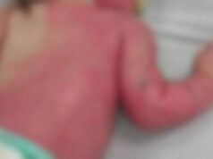 Santa Clara: Por una distracción, un bebé resultó con graves heridas