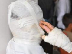 San Pedro: Bebía con sus amigos y estos le prendieron fuego