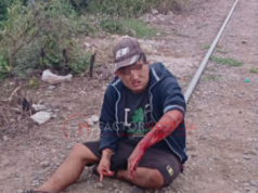 Conocido delincuente apodado «Vato» fue atacado con un vidrio y terminaron detenidos él y su agresora