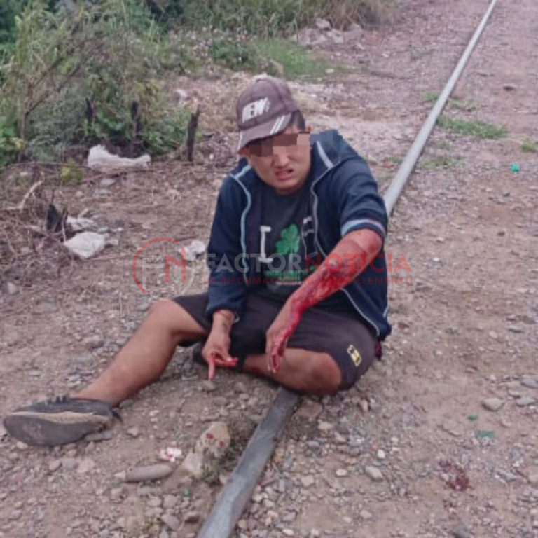 Conocido delincuente apodado «Vato» fue atacado con un vidrio y terminaron detenidos él y su agresora