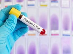 Hepatitis de origen desconocido: consejos para evitarla