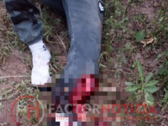 Accidente en Ruta Provincial 23: motociclista casi pierde un pie