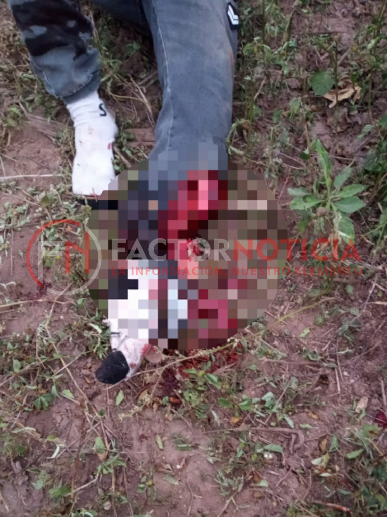 Accidente en Ruta Provincial 23: motociclista casi pierde un pie